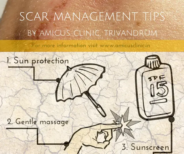 scar management tips