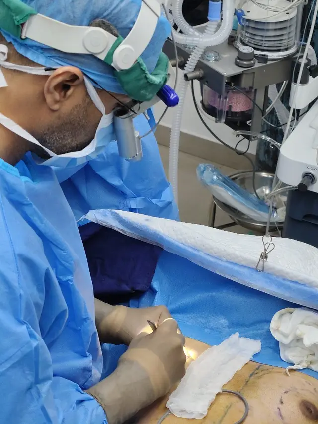 Gynecomastia gland removal